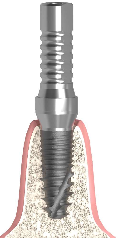 BIONIKA, Ideiglenes fej, multi-unit szintű, nem pozicionált, SR