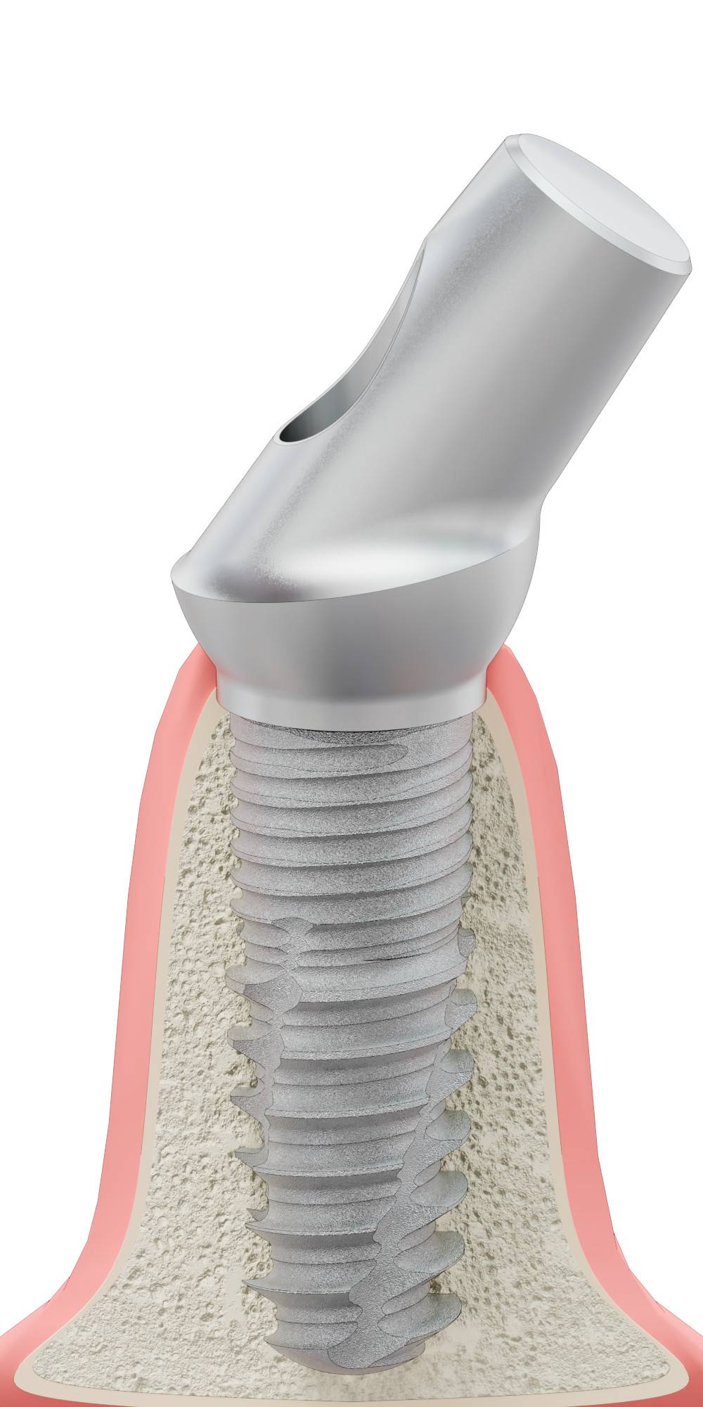 UNIFORM CX, Anatómiai fej, ferde, 35°, pozicionált, B-típus