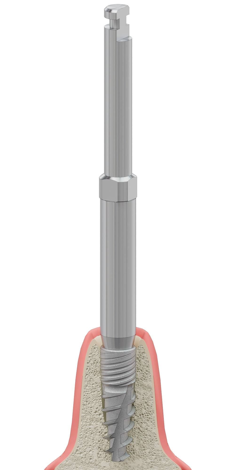 DENTUM, Implantátum behajtó, gépi, lamellás