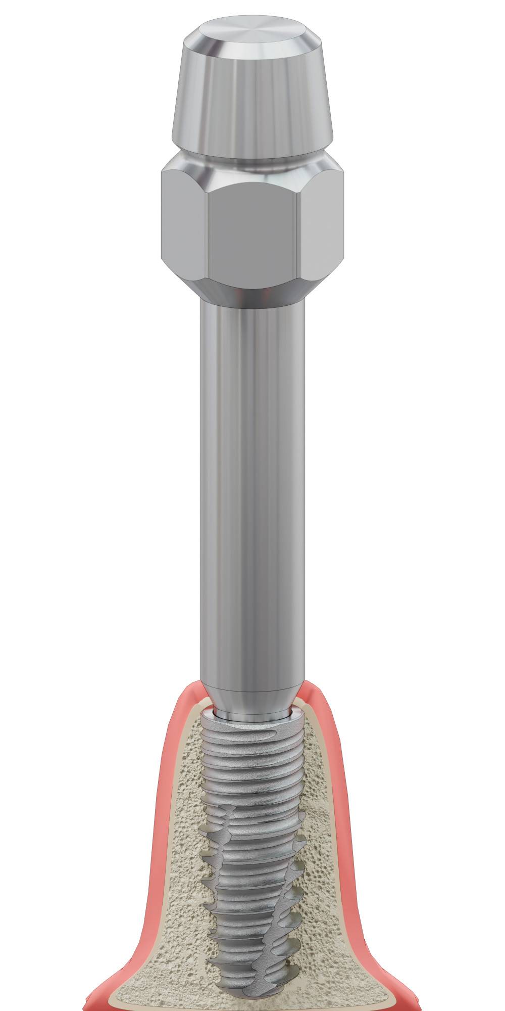 CORTICON, Implantátum behajtó, kézi, Bionika