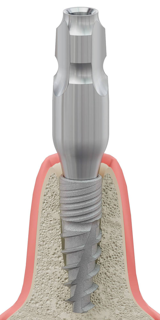 BIONIKA BIOPLANT, Mintavételi fej, zárt kanálhoz, uniform, pozicionált