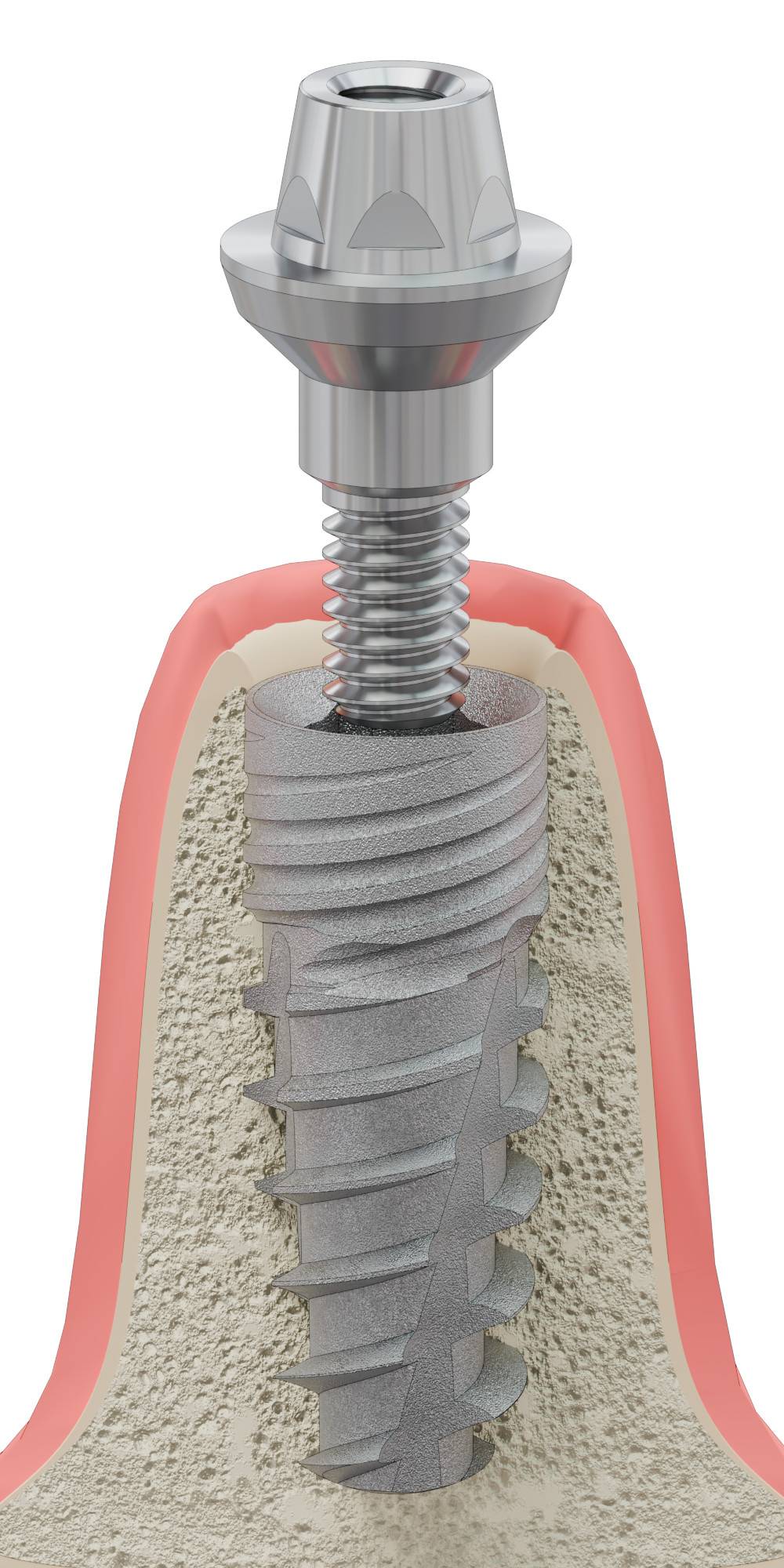 DENTUM, Multi-unit fej, egyenes, becsavarható, széles