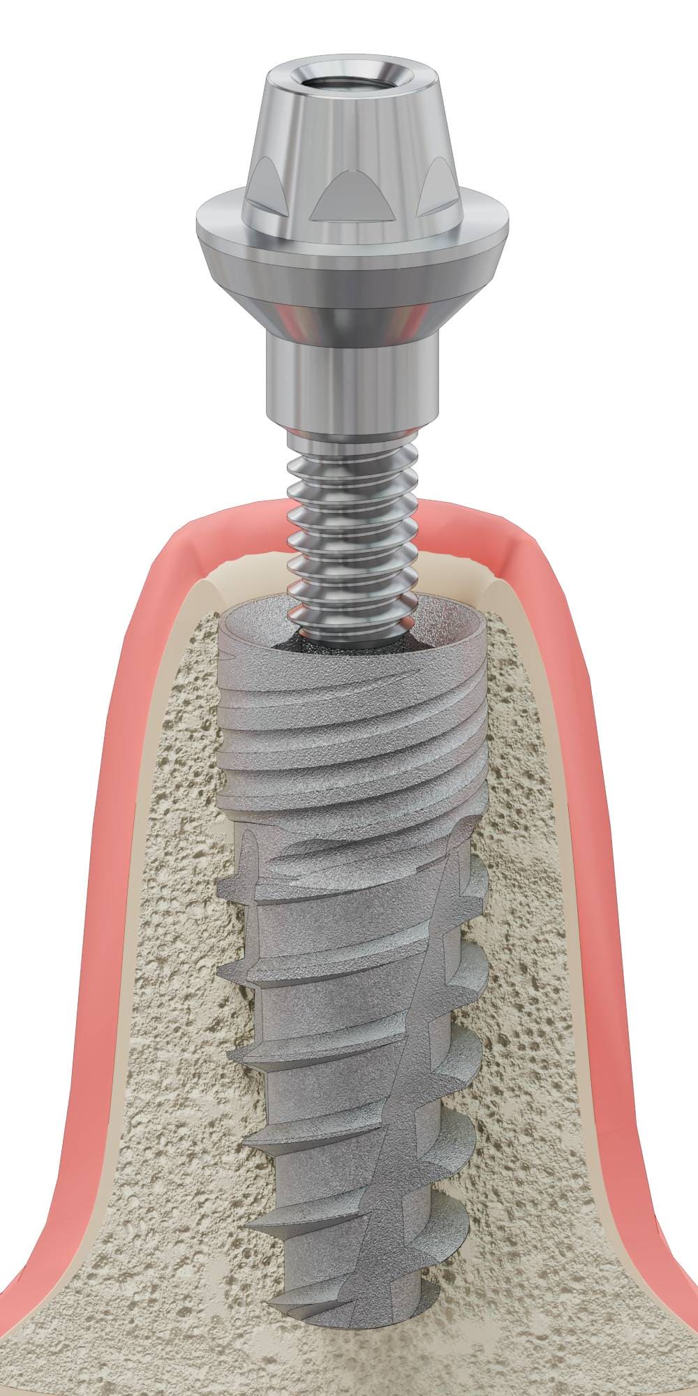 UNIFORM TH, Multi-unit fej, egyenes, becsavarható, széles