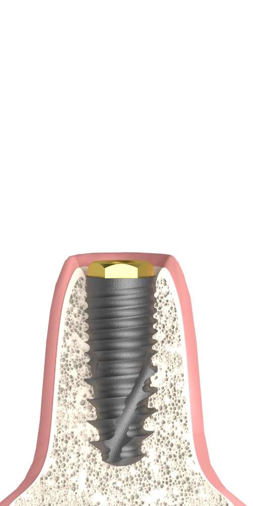 Dentium® NR Line (DN) Compatible BR hatszöges interface implant szintű, pozicionált