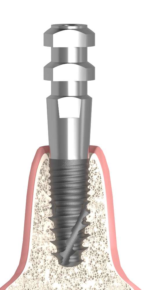 Oralplant® (OR) Compatible Mintavételi fej nyitott kanálhoz