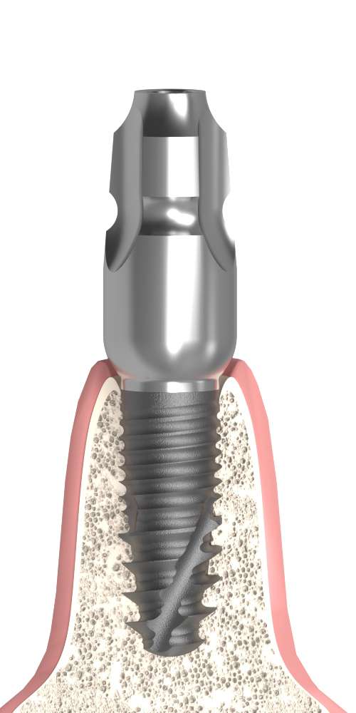 Dentium® NR Line (DN) UNIFORM Mintavételi fej zárt kanálhoz, uniform