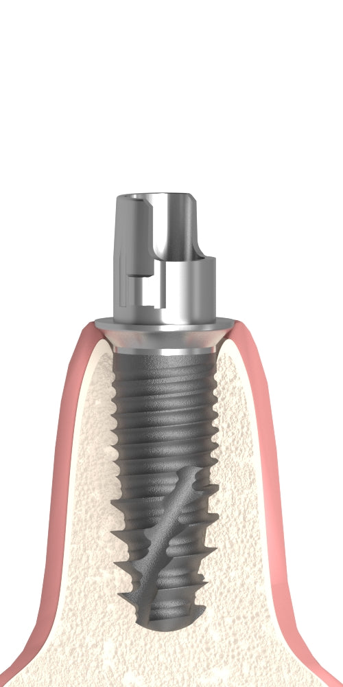 Dentium® Superline (DM) Compatible Titán bázis PCT lépcsős implant szintű, pozicionált