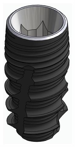 BIONIKA CORTICAL, Implantátum