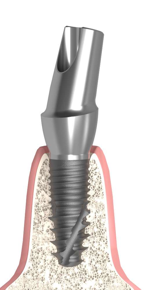 Dentum Anatómiai fej ferde