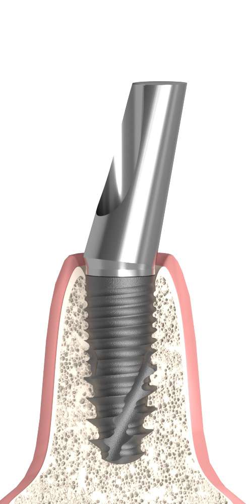 Dentum Keskeny fej ferde