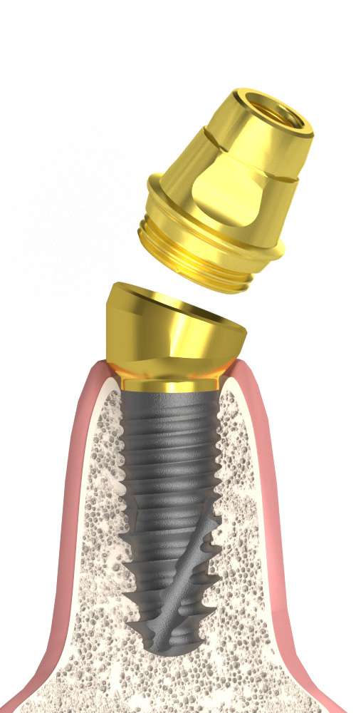 Oralplant® (OR) Compatible Multi-Compact csésze (MC fej) ferde, B-típus M1.6 SR kúppal