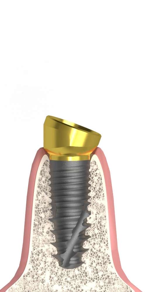 Implant Direct® Replant® (RE) Compatible Multi-Compact csésze (MC fej) ferde, B-típus
