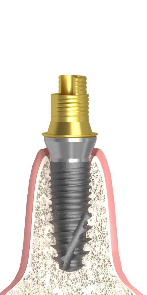 BIONIKA, Flexi bázis, multi-unit szintű, nem pozicionált, LT2.7, széles, M1.6