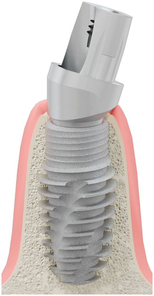 BIONIKA RP, Titán bázis, ferde, pozicionált, A-típus