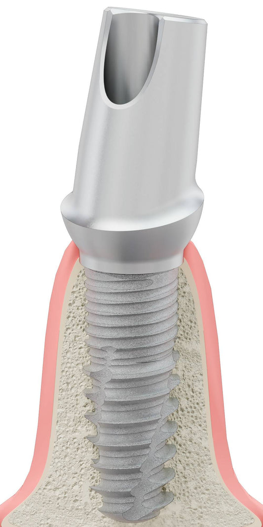 BIONIKA BIOPLANT, Anatómiai fej, ferde, 15°, pozicionált, A-típus