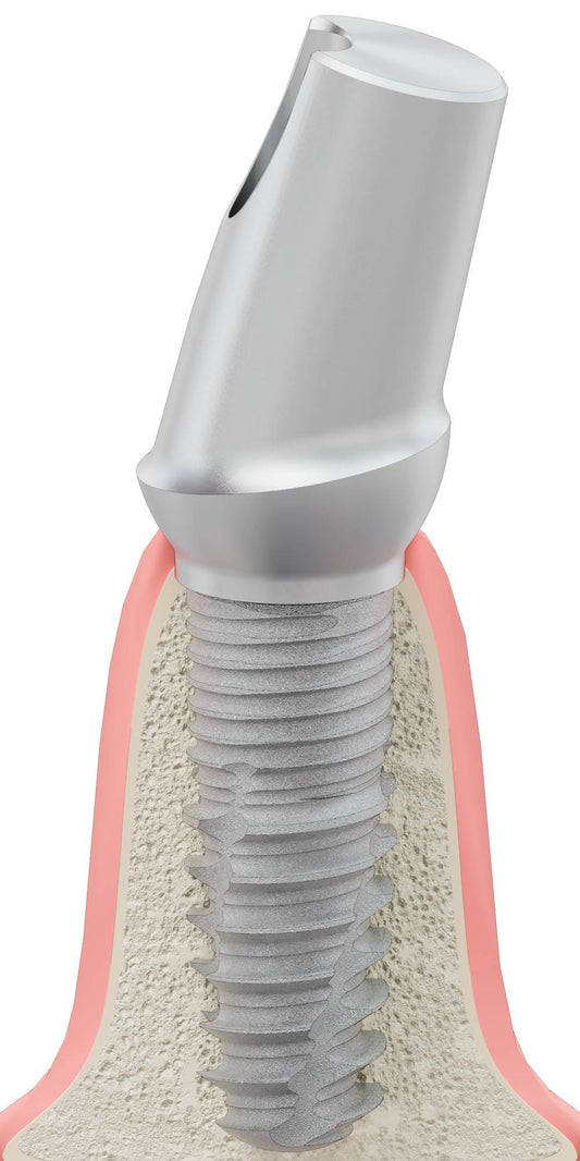 UNIFORM 3I, Anatómiai fej, ferde, 15°, pozicionált, B-típus