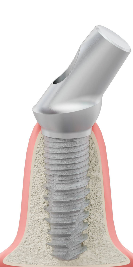 T-REX, Anatómiai fej, ferde, 35°, pozicionált, B-típus