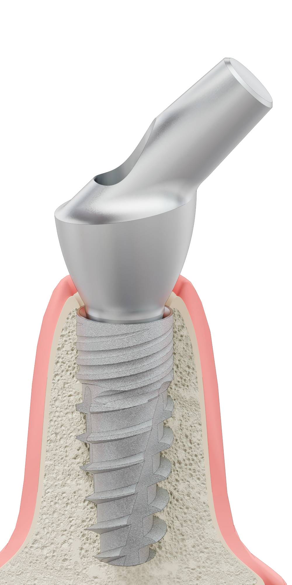 UNIFORM SGD, Anatómiai fej, ferde, 45°, pozicionált, B-típus