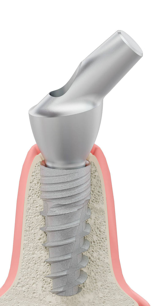 UNIFORM DI UF, Anatómiai fej, ferde, 45°, pozicionált, B-típus