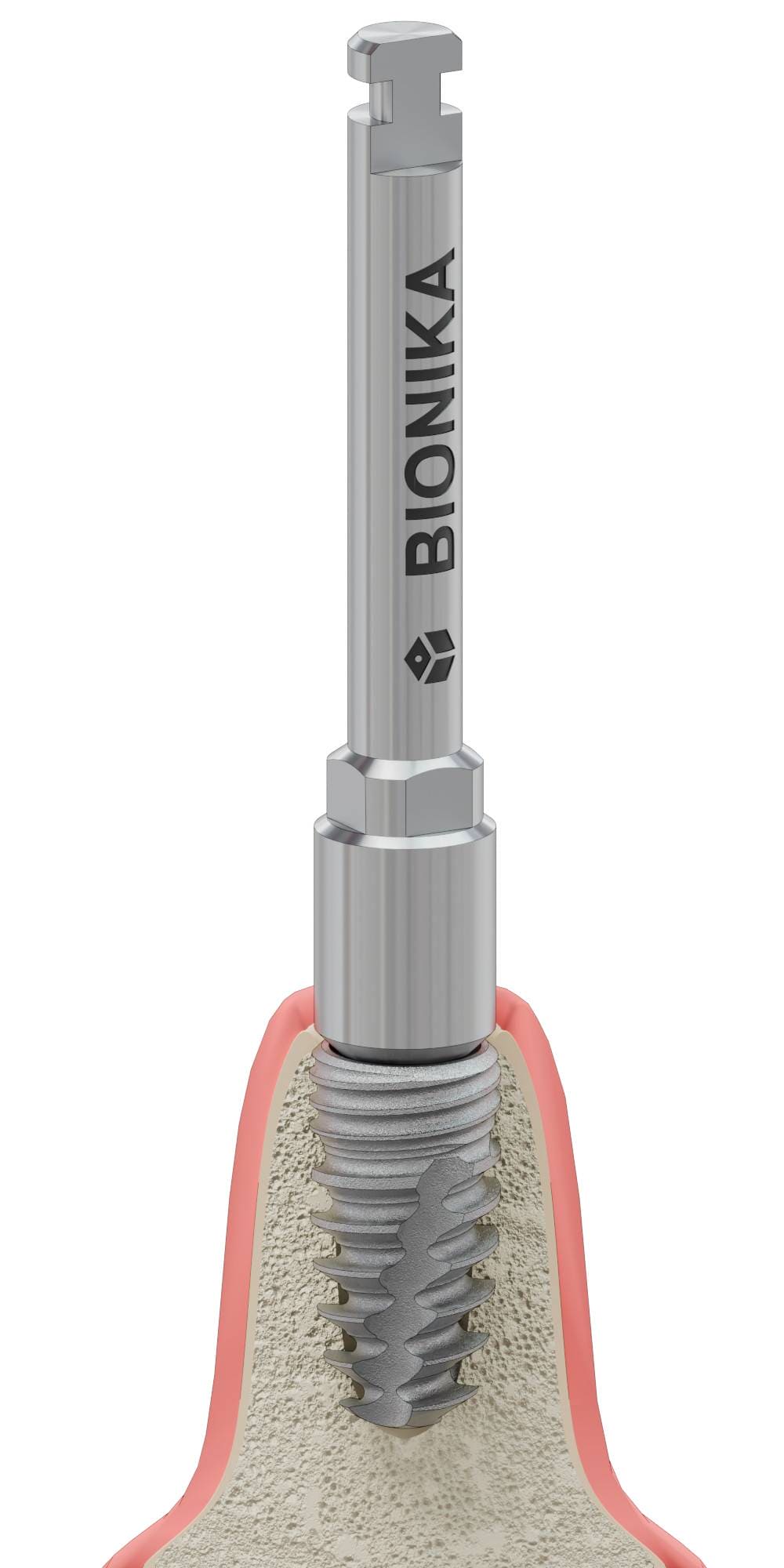CONEFIT, Implantátum behajtó, gépi