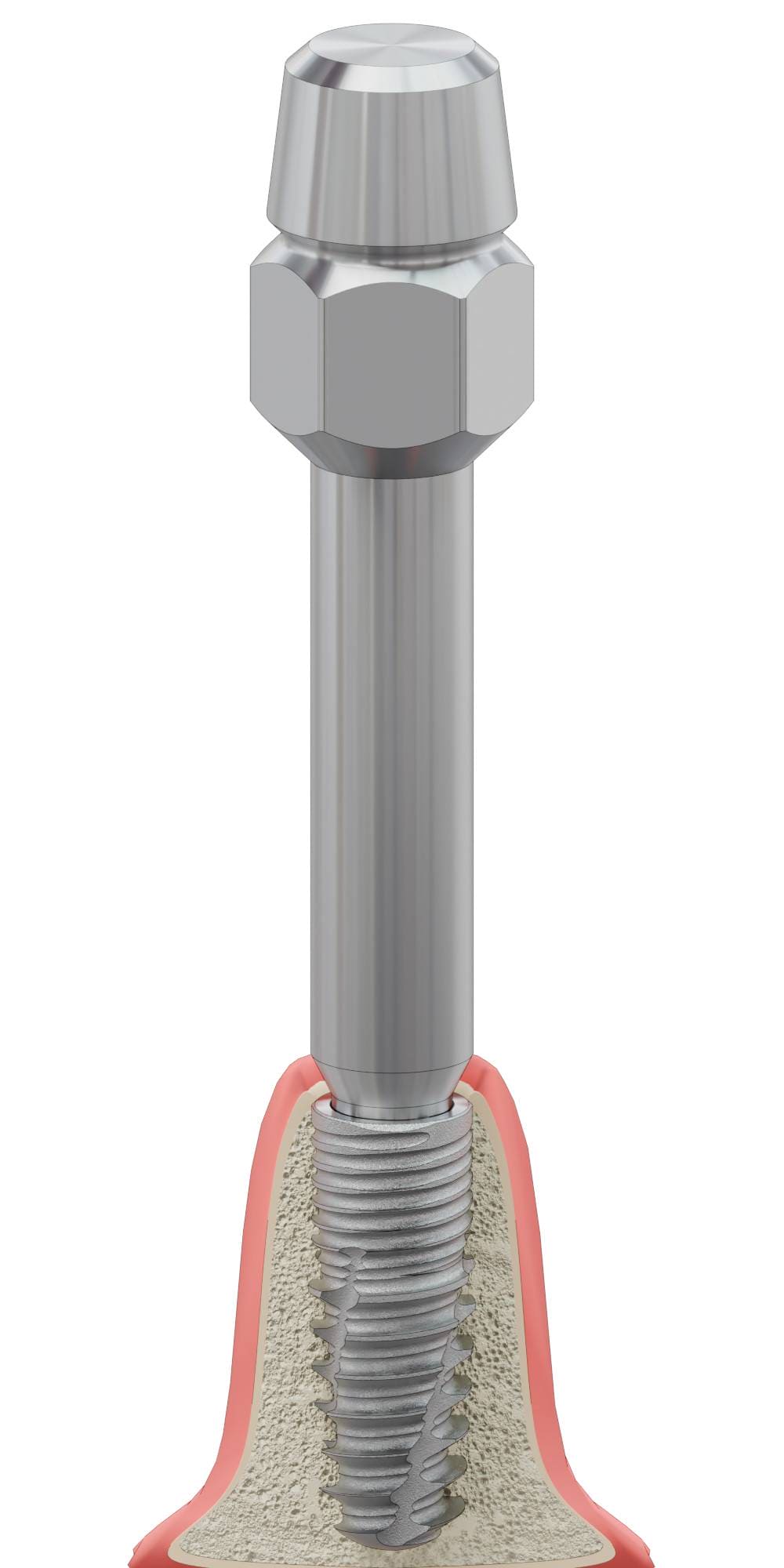 CONEFIT, Implantátum behajtó, kézi, Bionika