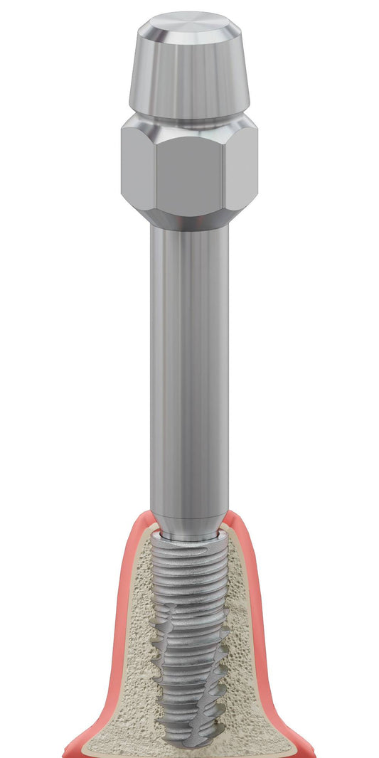 BIONIKA CX, Implantátum behajtó, kézi, Bionika