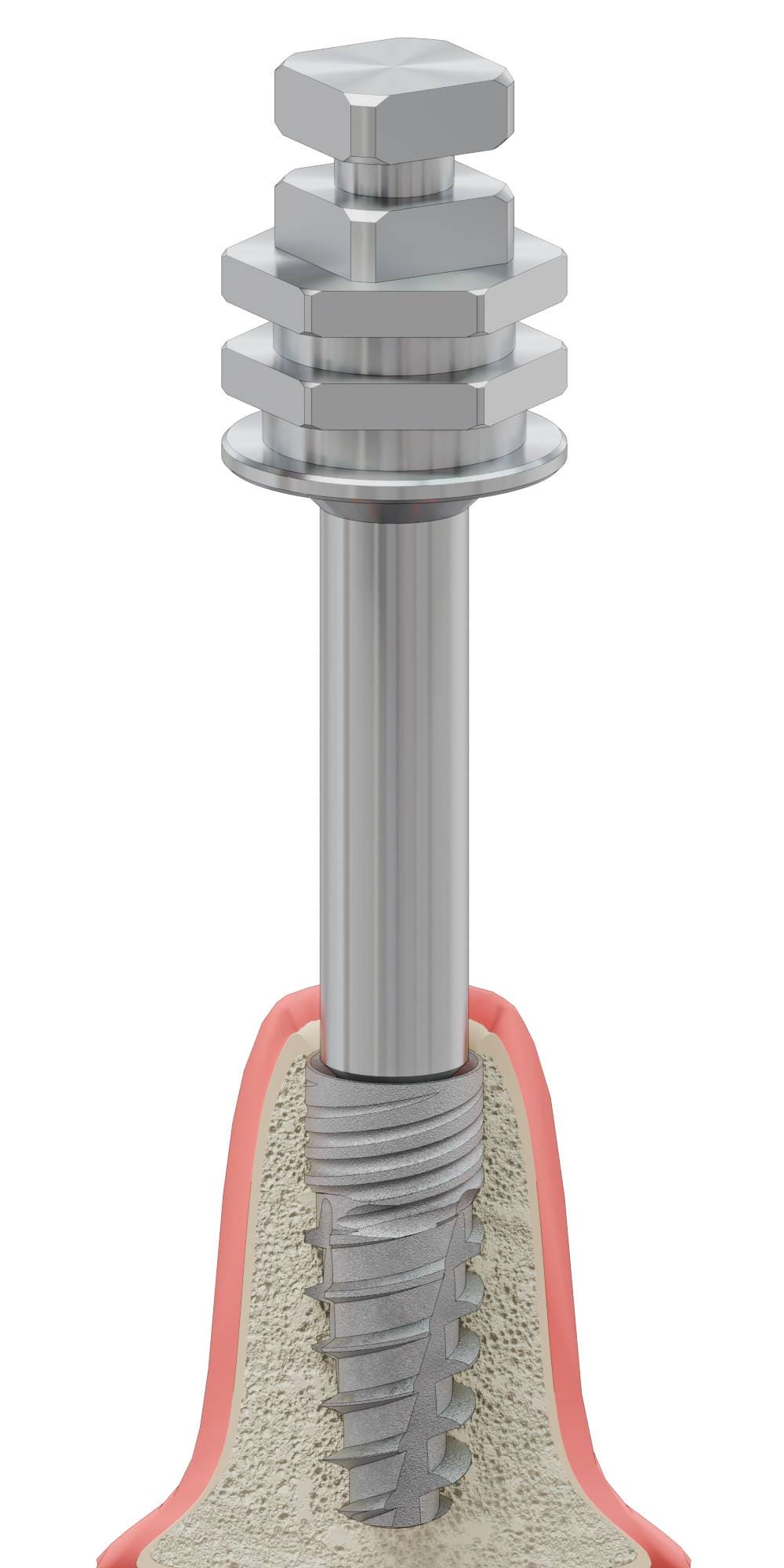 DENTUM, Implantátum behajtó, kézi, AB
