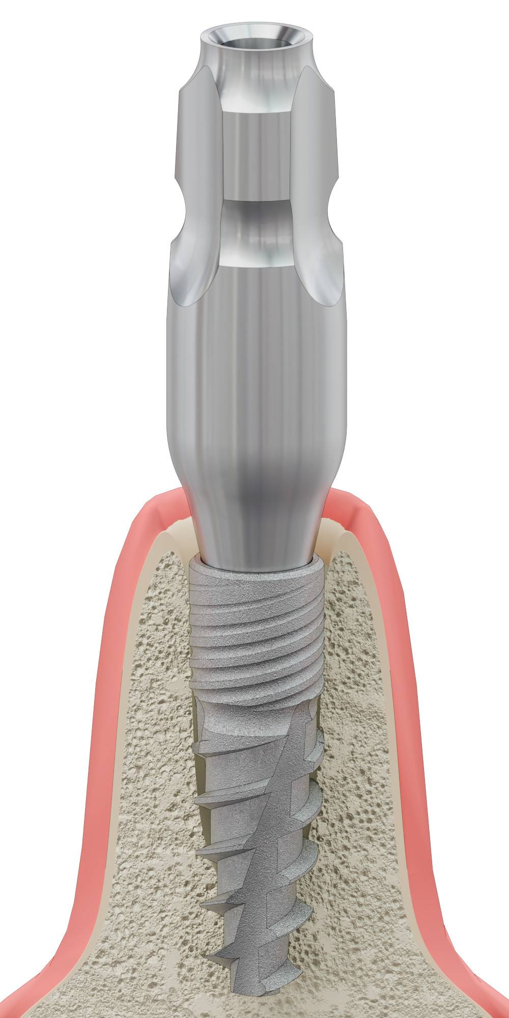 BIONIKA BIOPLANT, Mintavételi fej, zárt kanálhoz, uniform, pozicionált