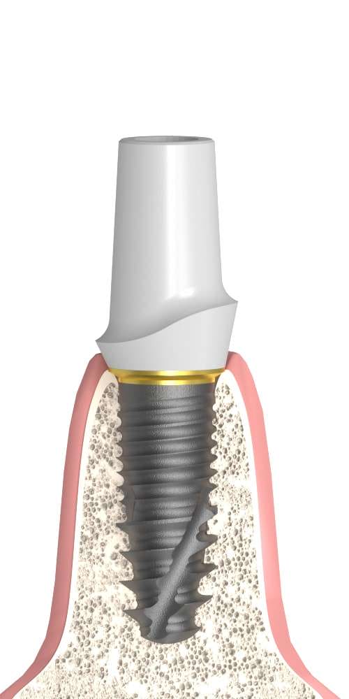 Oralplant® (OR) Compatible Cirkon fej titán alappal egyenes, nem pozicionált