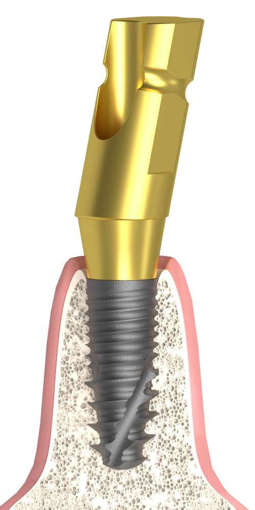 Oralplant® (OR) Compatible Mintavételi fej zárt kanálhoz ferde
