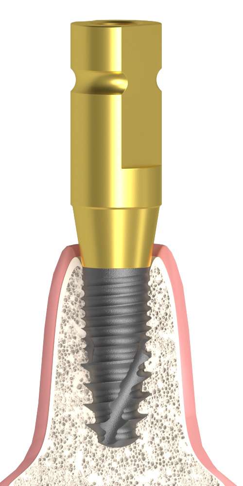 Dentium® Superline (DM) Compatible Mintavételi fej zárt kanálhoz parallel