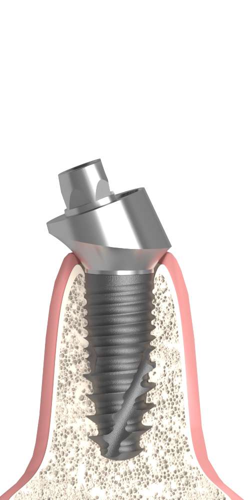 Dentum Multi-unit fej ferde átmenőcsavarral
