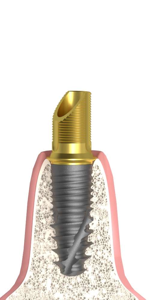MIS® C1® (C1) Compatible Préskerámia alap implant szintű, pozicionált