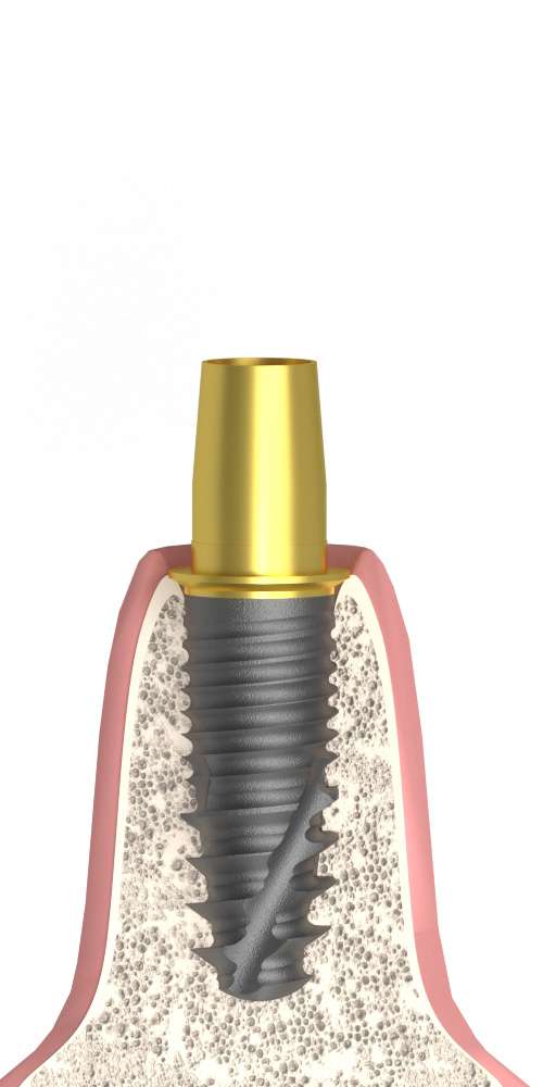 Nobel® Replace Select® (RP) Compatible Titán bázis implant szintű, nem pozicionált