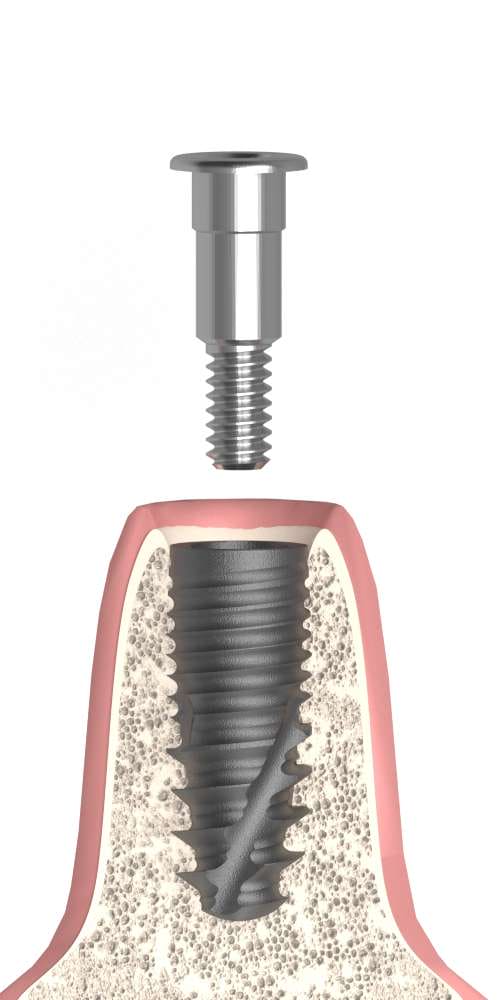 Implant Direct® InterActive® (ID) Compatible Zárócsavar