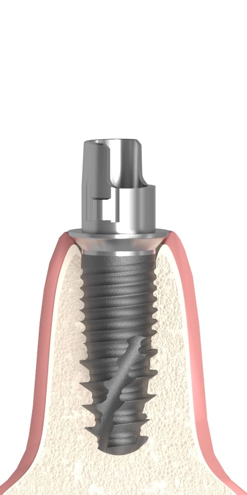 MIS® V3® (V3) Compatible Titán bázis PCT lépcsős implant szintű, pozicionált